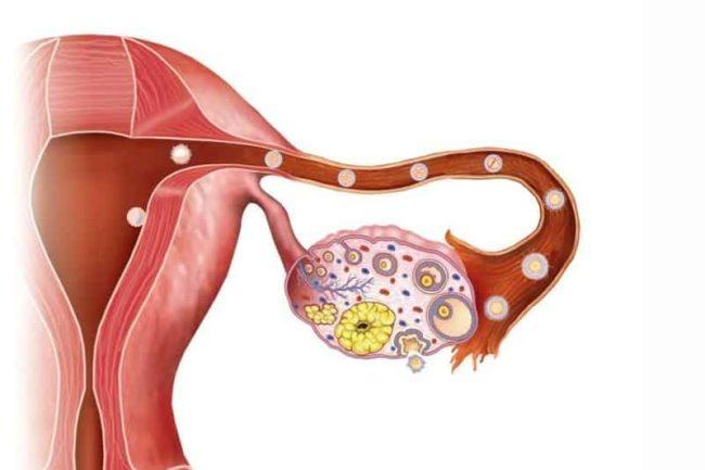Можно ли забеременеть при дисфункции яичников: что это значит, причины, шансы на зачатие, как пройдет беременность
