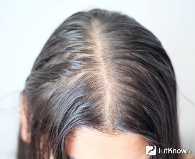 Жирная кожа головы