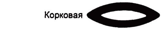 Корковая катаракта Корковая катаракта