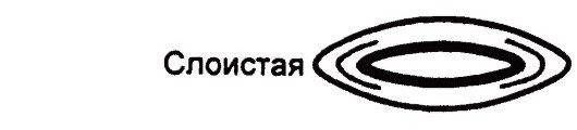 Слоистая катаракта Слоистая катаракта