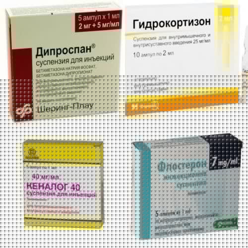 Боли в локтевом суставе синдром теннисиста