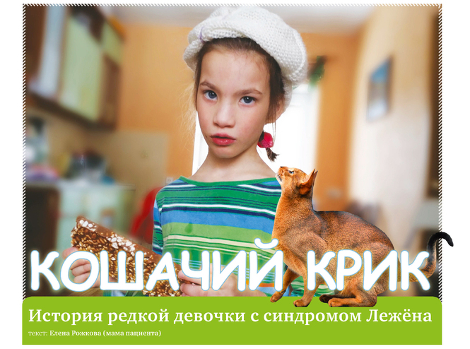 Фото детей с синдромом лежена