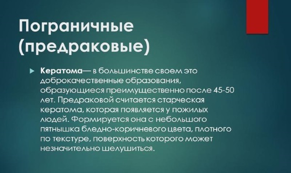 Кератома кожи - симптомы и лечение у взрослых, фото на лице, голове. Себорейная, старческая, сенильная