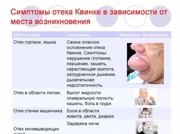 Код мкб отек квинке