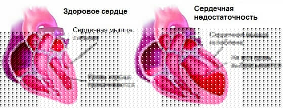 325326